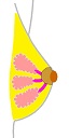 Ductal carcinoma