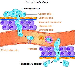 Metastasis