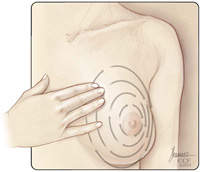 Palpation of the breast. Item 5