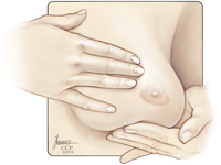 Palpation of the breast. Item 3