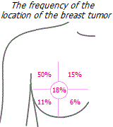 Prevalence of tumor location