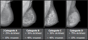 Mammografische dichtheidscategorieën