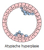 Metaplasie