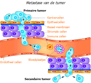 Metastase