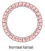 Normaal kanaal