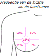 Prevalentie van tumorlocatie