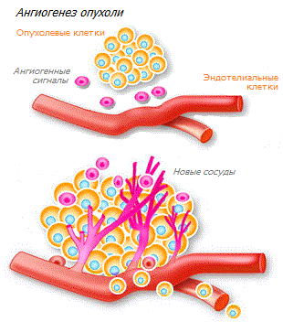 Ангиогенез