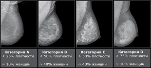 Категории маммографической плотности