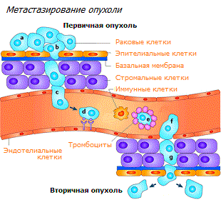 Метастазирование