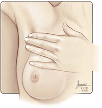 Пальпация груди, пункт 2